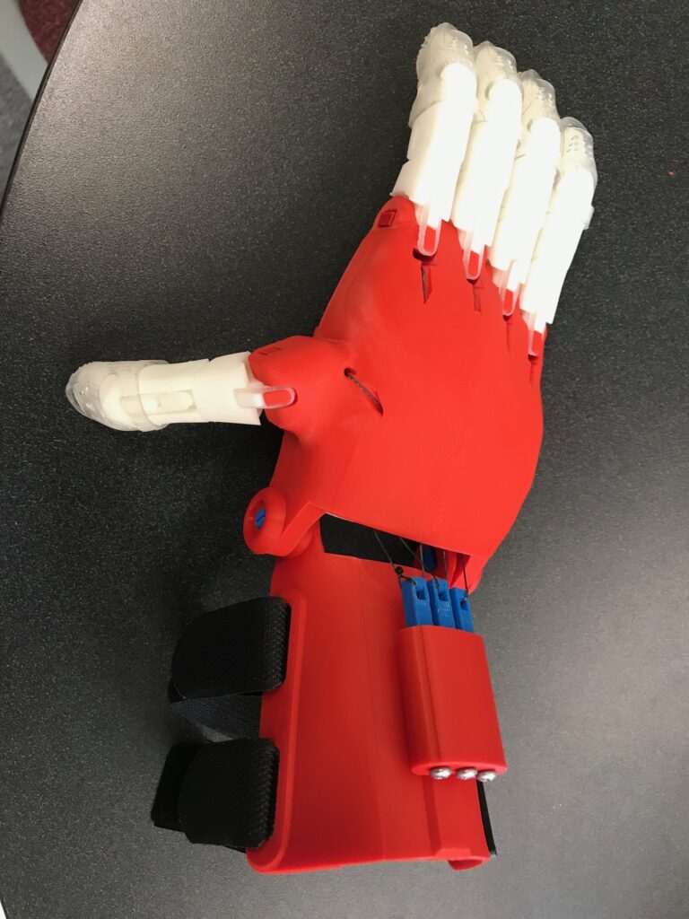 Red and white 3-D printed prosthetic hand